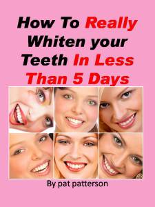 Teeth Whitening in 5 days